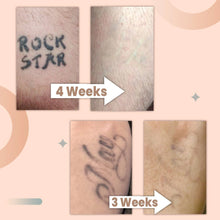 Load image into Gallery viewer, Tatoff 4 Weeks Tattoo Removal Cream
