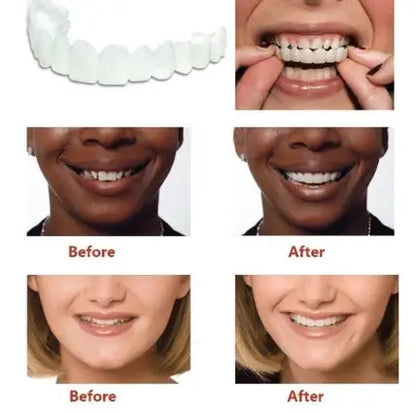Magic Teeth (Upper & Lower Set)